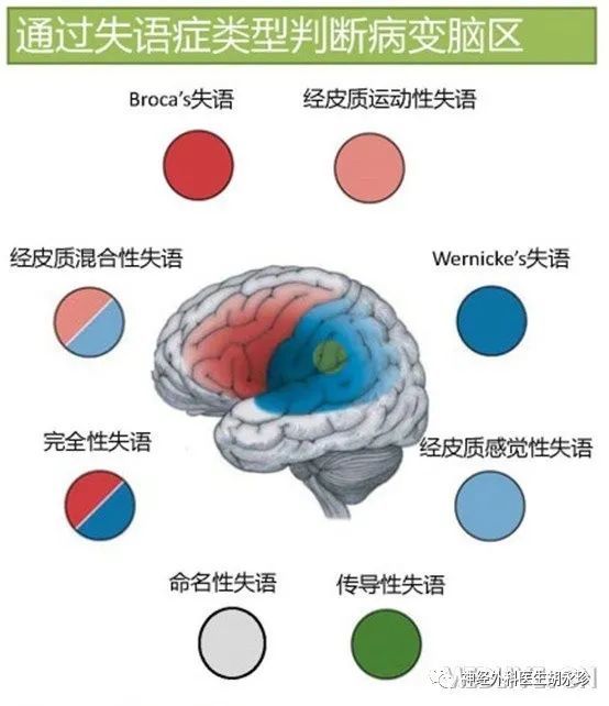 [电报式语言是什么失语]电报式语言常见于什么失语