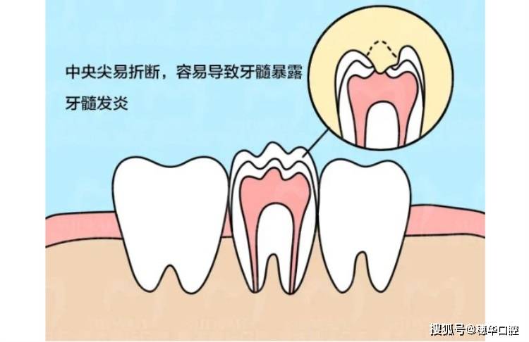 TGs在医学上是什么-TGs在医学上是什么的缩写?是什么意思