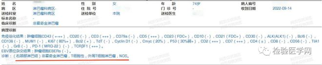 tp钱包的u莫名被转账了-tp钱包被骗了能不能找回钱