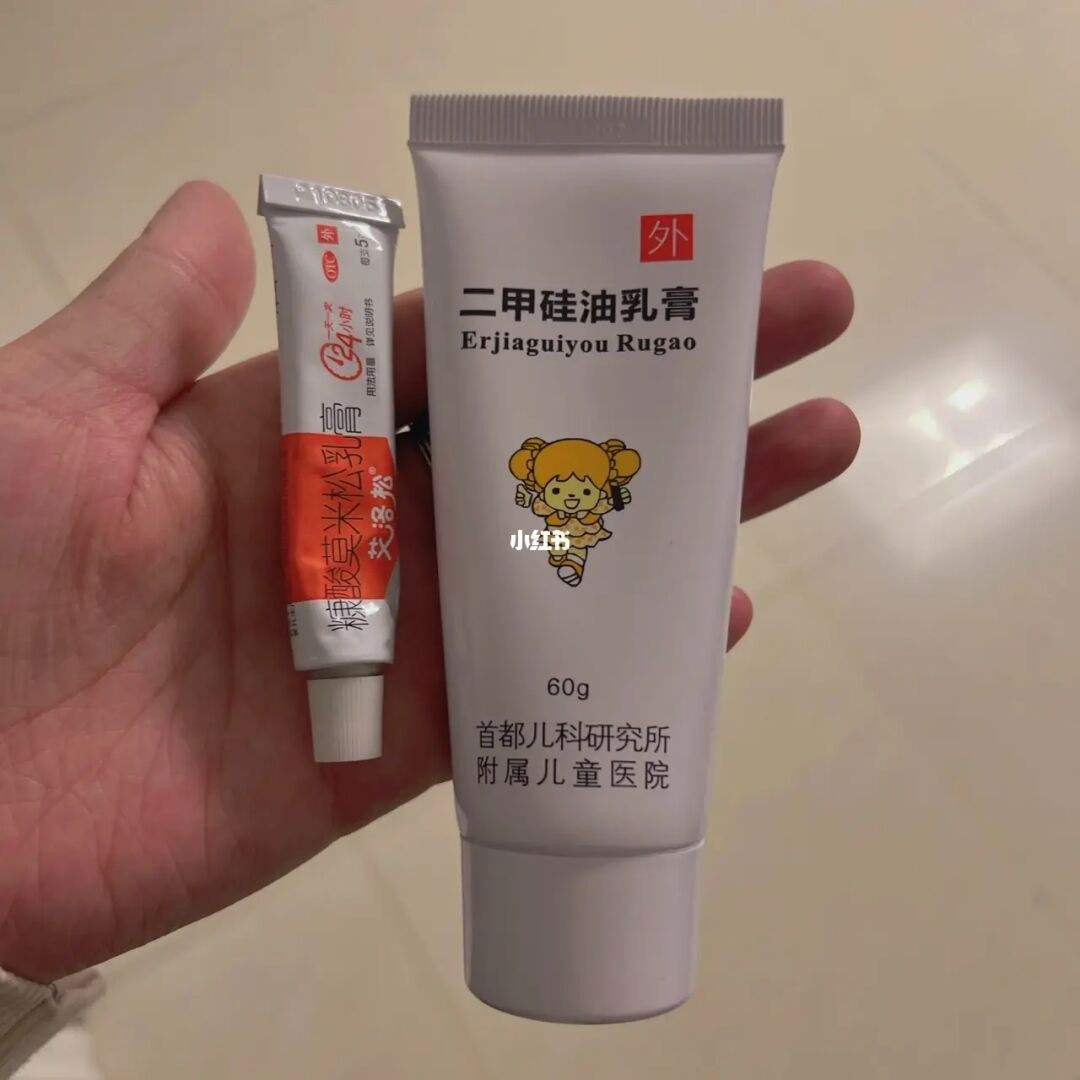 去除婴儿热疹小妙招-热疹最简单的自愈方法