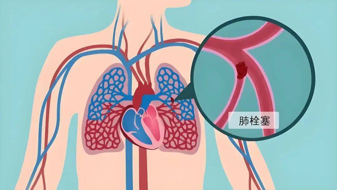 cta动画制作，cta动画软件自学